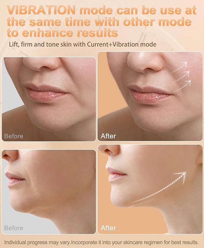 Radio Frequency Skin Tightening Device | 6 in 1 Home RF Face Beauty Device | Professional Facial Skin Tightening | Lifting | Wrinkle Reducing | Anti Aging | Depuff | Increase Absorption(with Gel)