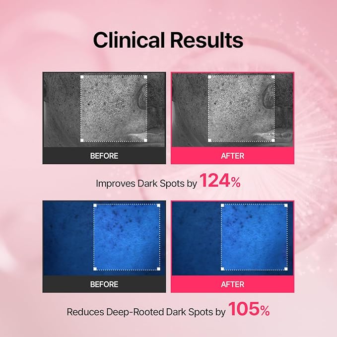 MEDITHERAPY Tranexamic Acid Skin Booster Cream 3.4 Fl Oz - 5% Niacinamide & 3% TXA Korean Face Moisturizer - Gentle Facial Serum Cream with Facial Device for Glass Skin - Radiant Complexion