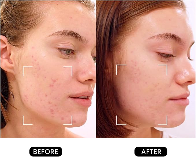 DermRays Revive Skincare for Anti-Aging, Glow Like Never Before,Multifunctional Beauty Device, Facial Massager for Home Use