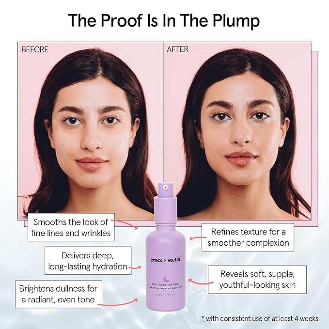 grace & stella Retinol Serum for Face with Hyaluronic Acid (50ml/1.7 fl oz) - Restoring Retinol Hyaluronic Acid Serum for Face to Reduce Fine Lines & Wrinkles - Acido Hialuronico - Vegan Skincare