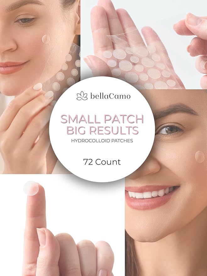 Pimple Patches- Advanced Acne Treatment For Zits and Blemishes. Hydrocolloid Spot Treatment with Salicylic Acid & Tea Tree Oil- Pimple Patch for Face- 72 ct