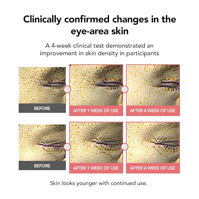 107% Smoother Crow’s Feet & 104% Lifted Skin – Boosts Elasticity & Moisture – Firms & Restores Radiance with 10% Collagen Water & Hyaluronic Acid – Korean Skincare Best Collagen Cream