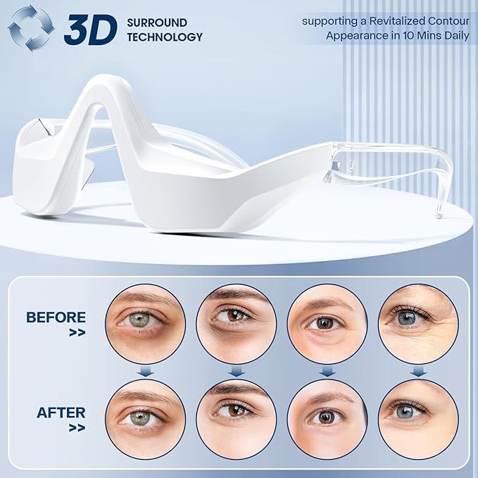 Under-Eye Therapy Device, RedLight Therapy Glasses for Eyes Bags Dark Circles Puffiness, Massager for Relieving Eye Fatigue with 3 Modes