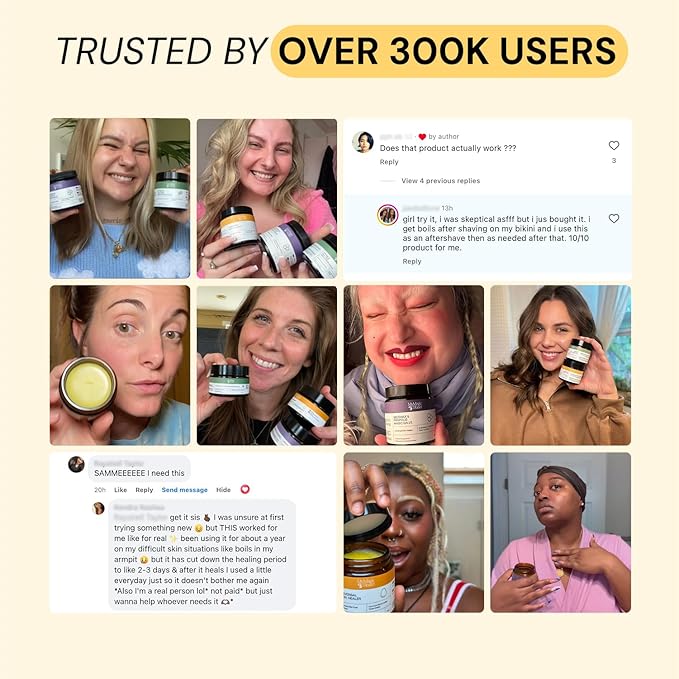 MyMagicHealer Universal Flare Care | Essential Oil Free | Relief for Rashes, Eczema, Psoriasis, Hidradenitis Suppurativa, Impetigo, Dermatitis, Wound Care, Sensitive Skin w/Propolis & Egg Yolk 4 oz