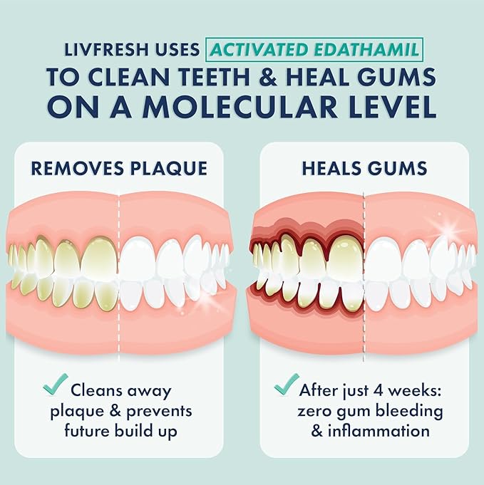 LIVFRESH Toothpaste Gel, Clinically Proven to Remove Plaque 250% Better, Improves Gum Health 190% Better, Prevents & Reduces Tartar, Freshens Breath, SLS Free Dental Gel, Wintergreen, 2 Pack