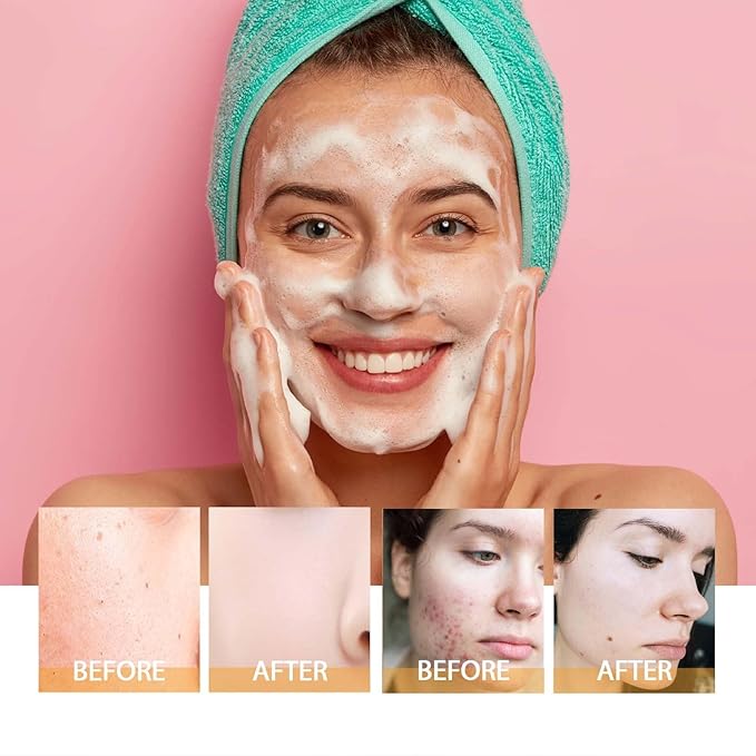 Turmeric Face Wash with Brush, Turmeric Foaming Face Cleanser, Deep Cleansing Exfoliating Moisturizing for Women, All Skin (1,Face wash)