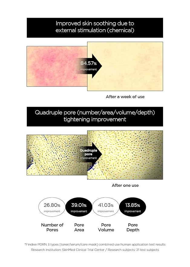 FINDIVE OFFICIAL PDRN CICA Exosome Care Mask, PDRN (Sodium DNA) 5,000ppm, Cica Exosome, Marin Collagen, Soothes, Regenerates Skin, 1.05fl.oz*8