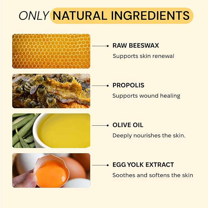 MyMagicHealer Universal Flare Care | Essential Oil Free | Relief for Rashes, Eczema, Psoriasis, Hidradenitis Suppurativa, Impetigo, Dermatitis, Wound Care, Sensitive Skin w/Propolis & Egg Yolk 4 oz