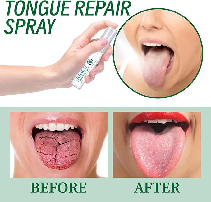 Tongue Repair Spray, Oral Care Mist with Mint Extract, Castor Oil, Lemon Extract for Dry Mouth, Fresh Breath, pH Balance