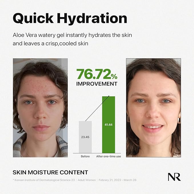 Nature Republic MILD & MOISTURE ALOE VERA WATERY GEL (TUBE) Quick Hydration & fast absorbing non-sticky texture, aftersun cooling pack, Moisturizing Face Skin & Hair,korean skin care All Skin Types