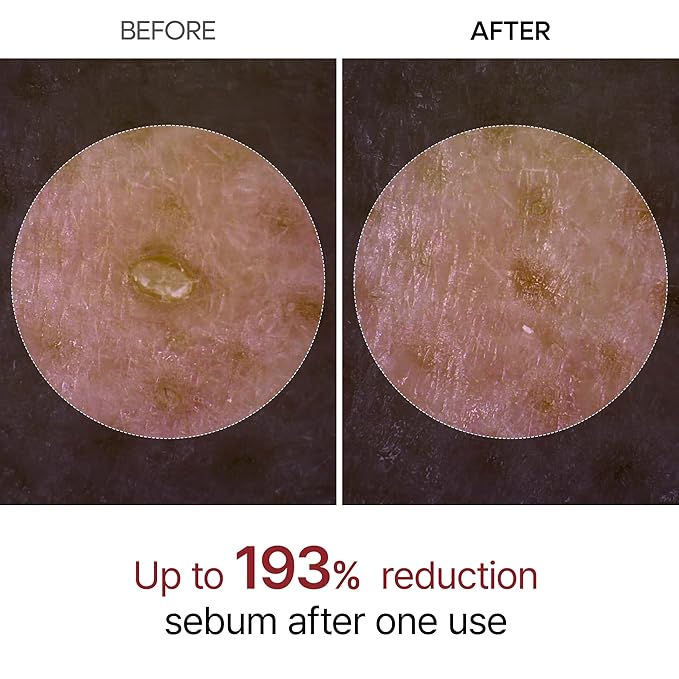 Dr.Melaxin Peel Shot Glow White Rice Peeling Ampoule, Soft Exfoliating Face and Body Scrub Dead Skin Cells Remover for All Skin Types korean skin care 80ml