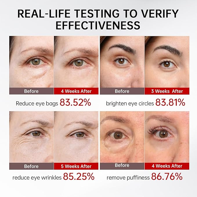 Retinol & Caffeine Eye Serum -360° Massage Roller for Puffiness,Eyebag Remover,Wrinkle Filler,Under Eye Cream For Dark Circles 0.54fl.oz (Pack of 2)