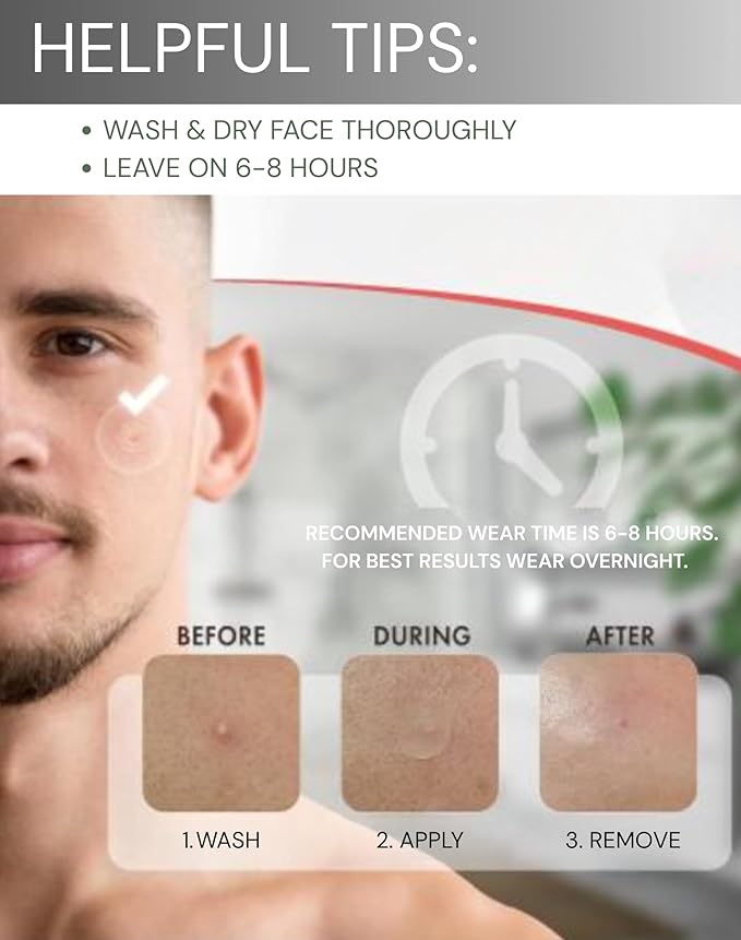 Clear Pimple Patches- Hydrocolloid Fast Acting Pimple Patch w/ Salicylic Acid & Tea Tree Oil Fights Breakouts & Blemishes. Acne Spot Treatment for Face- 108 Ct.