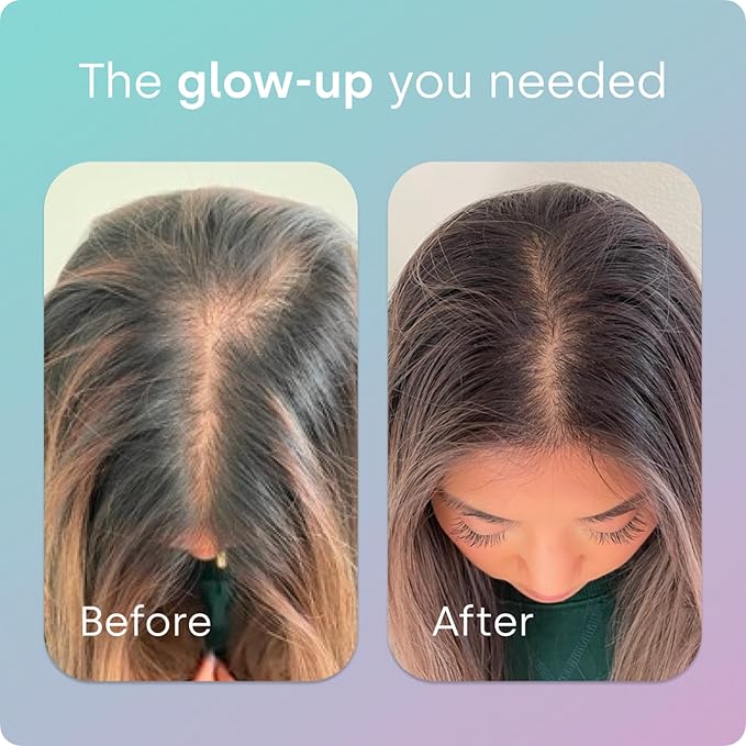 Biosil Advanced Hair + Nail Care - Growth Vitamins for Women - Strengthen & Thicken Strands - 60 Capsules - Patented ch-OSA - 30-Day Supply