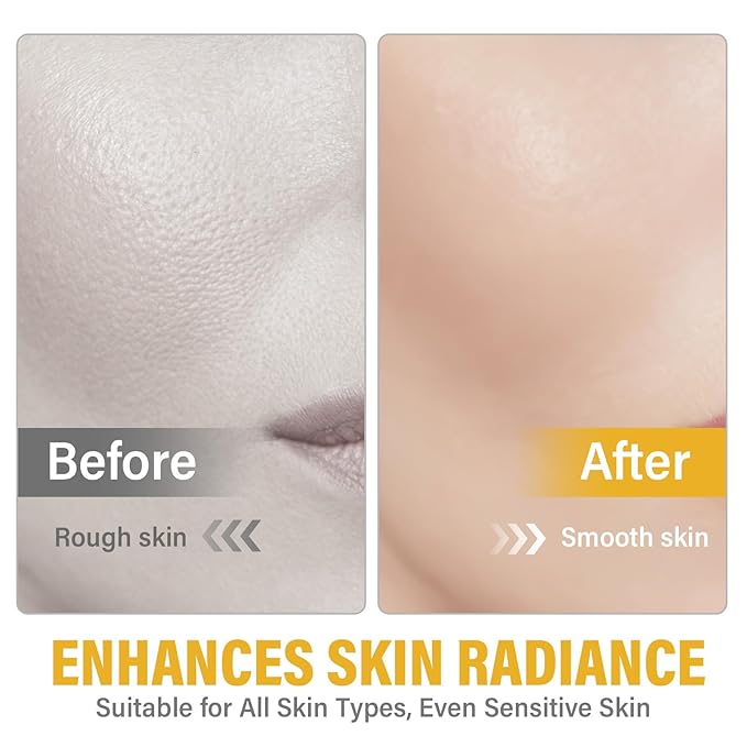 Salmon DNA Ampoule, 35ml Microneedling Serum, Hydrates & Moisturizes Skin, Anti-Wrinkle & Enhance Barrier Function for Face and Body