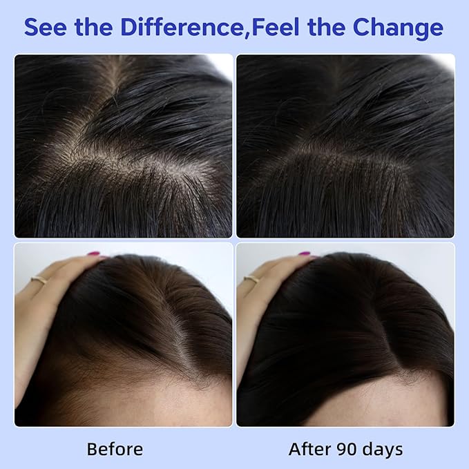 Hair Growth Serum with Rosemary Oil & Saw Palmetto - 100% Natural Plant-Based Formula to Stimulate Follicles, Revive Roots for Visibly Thicker Fuller Hair, Reduce Shedding and Loss For Men & Women