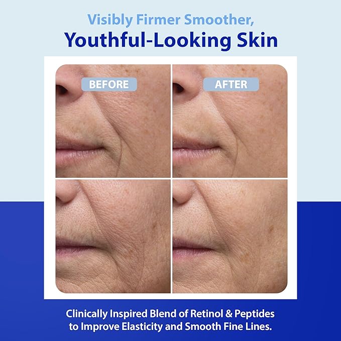 SkinScience HydroShield Dream Cream 3.4 oz – Advanced Moisturizer with Retinol, Peptides and Ceramides for Smooth Radiant Skin, Improved Elasticity and Deep Hydration – Doctor Developed, Cruelty Free