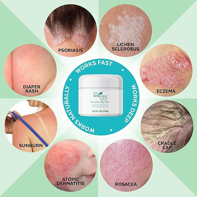Soothe My Skin Cream for Sensitive Skin - Stocking Stuffers. Eczema Cream Psoriasis Atopic Dermatitis Lichen Sclerosus. Emu Oil with Only Natural Ingredients