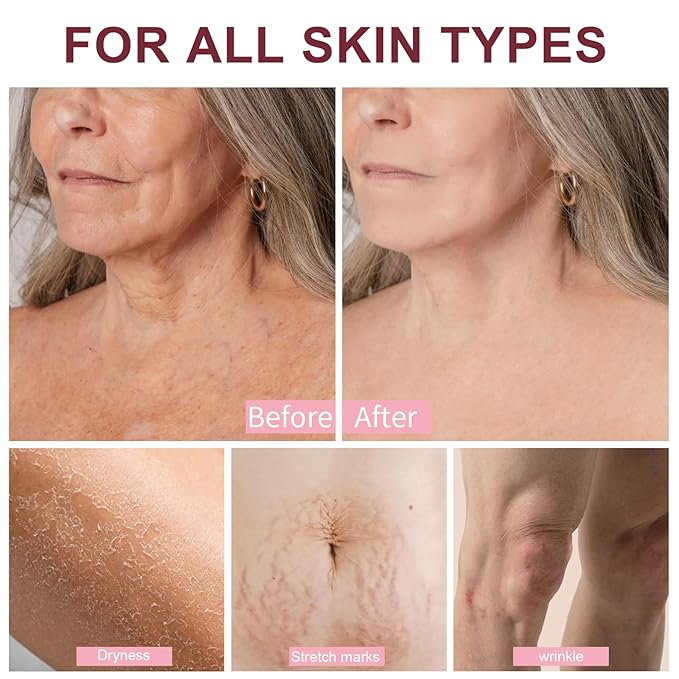 Mythic Body Firming Oil Skin Tightening Body Oil After Shower for Women Tighten Hydrate & Nourish Dry Skin 4 FL OZ(Citrus)