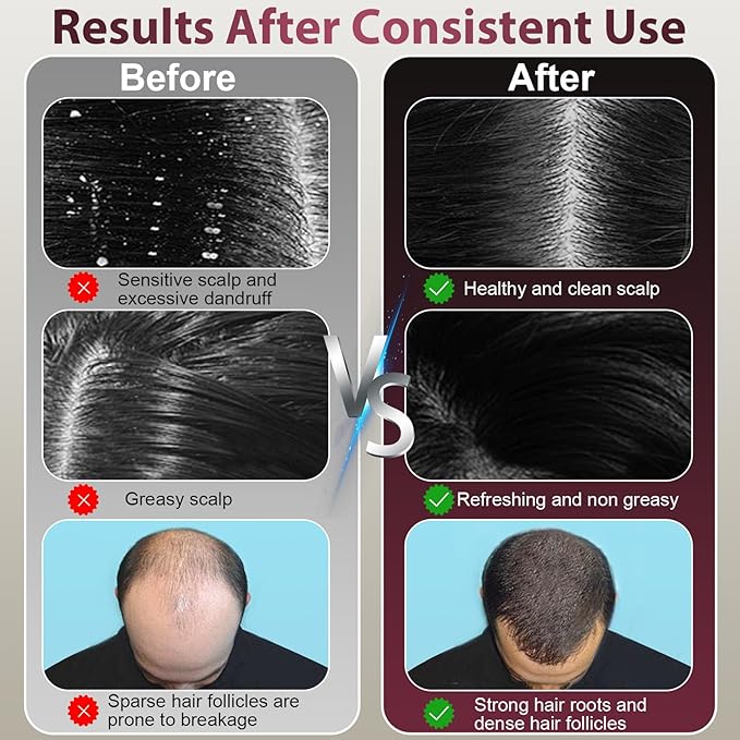 Laser Therapy Hair Growth Comb, Hair Oil Applicator,Electric Scalp Massager Hair Growth with IPX7 Waterproof