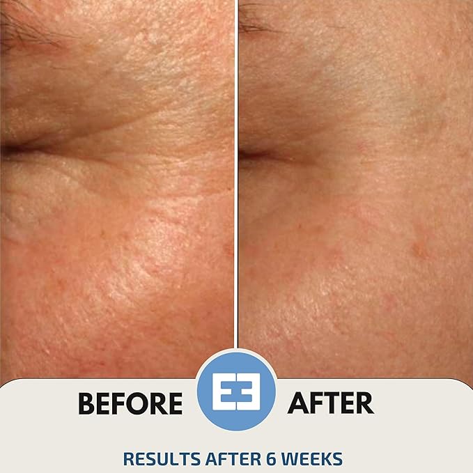 EiE 01 Klotho Peptides Serum for Face Hydrating Peptide Face Serum for Women Anti Aging Improves Wrinkles Elasticity Facial Peptide Serums with Hyaluronic Acid and Retinol Made in Sweden 1oz