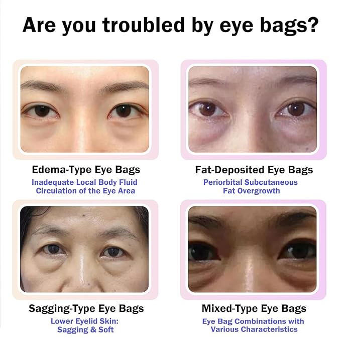 Anti Aging Eye Cream with Hyaluronic Acid & Vitamin E – Hydrating Under Eye Cream for Visible Wrinkles & Bag Appearance, Helps Visibly Tighten & Reduce Puffiness