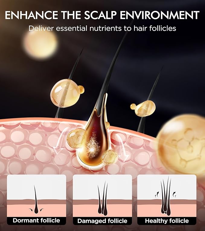 Hair Growth Biotin Shampoo and Conditioner Set, Onion Anti-Loss Volumizing Moisturizing Treatment for Soft Shine Hair, Rosemary Clarifying Dandruff Shampoo for Women Men, 2 x 16.9oz