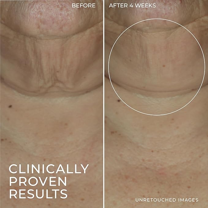 RoC Derm Correxion Retinol Firming Serum Stick with Antioxidants to Visibly Tighten and Firm Wrinkles and Laugh Lines 1.0 oz plus Retinol Eye Cream Packette