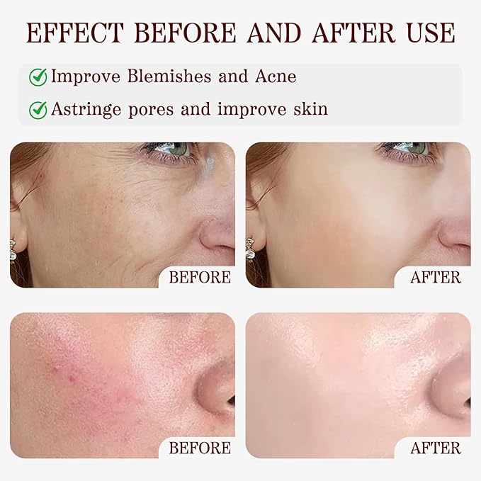 Black and White Rice Peeling Ampoule，2025 New Soft Exfoliating Face and Body Scrub，Black and White Rice Exfoliant for All Skin (White+Black, 3.38 Fl Oz (Pack of 1))