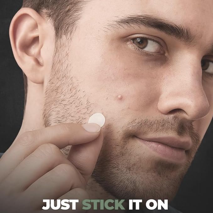 Clear Pimple Patches- Hydrocolloid Fast Acting Pimple Patch w/ Salicylic Acid & Tea Tree Oil Fights Breakouts & Blemishes. Acne Spot Treatment for Face- 108 Ct.