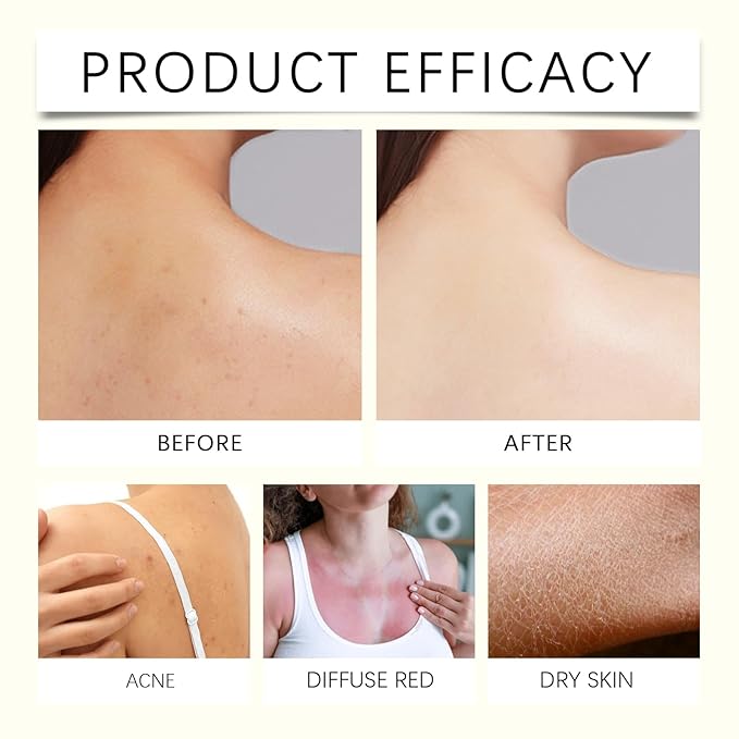 Magic Luxury Body Oil,Jojoba Ginger Extract – Skin Firming, Intense Hydration for Dry Skin, Nourishing Full Body Treatment, Non-Greasy Fast Absorbing Formula