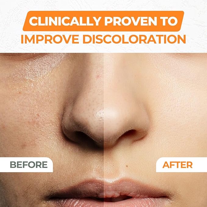 Vitamin C Serum For Face With Hyaluronic Acid, Vitamin E & Ferulic Acid - Brightening & Anti-Aging Formula for Glowing Skin - Hydrates, Evens Tone & Reduces Fine Lines - 60ml