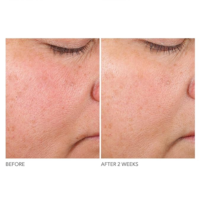 Dr. Dennis Gross Advanced Retinol + Ferulic Texture Renewal Serum – Anti-Aging Formula to Smooth Texture, Boost Radiance, and Minimize Fine Lines & Wrinkles, 1 oz