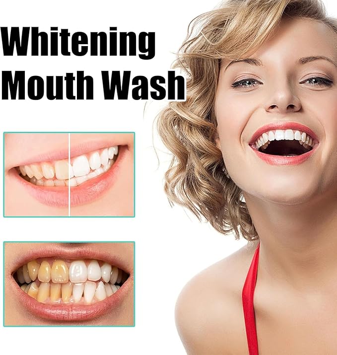 Oil Pulling Rinse - Natural Oral Cleanse & Teeth Whitener, WhiteOil Pulling Rinse, Mouthwash with Organic Cold-Pressed Coconut 𝐎il, Fresh Breath, Say Goodbye to Bad Breath (2)