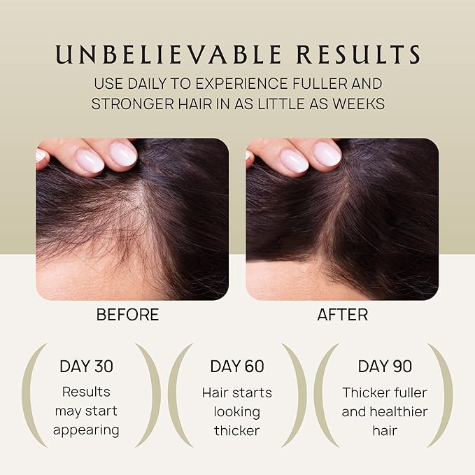 Hair Growth Oil Spray - 100% Pure Ingredients For Non Greasy, Thicker & Stronger Hair - Organic Batana, Castor, Biotin, Saw Palmetto, and Rosemary Oil for Men & Women Scalp - 4.1 Fl Oz