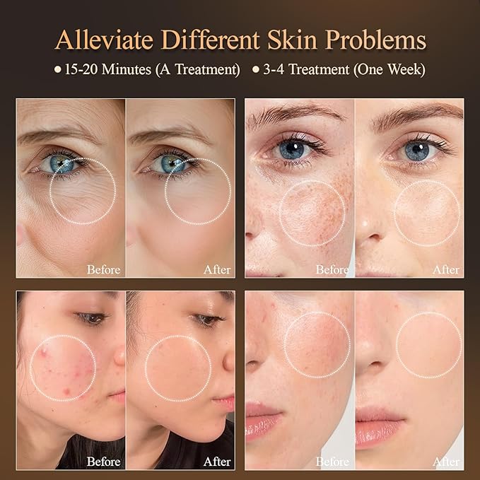 MEGELIN 7 Colors Led Light Therapy Facial Mask, Face Light Therapy Mask for Face, Reduce Wrinkles Smooth Skin, Infrared Light Skin Rejuvenation(White)