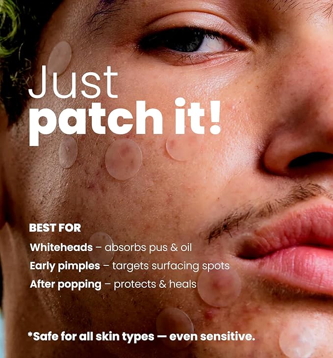 ROSELYNBOUTIQUE Pimple Patches for Face 300 Counts 4 Sizes Hydrocolloid Acne Patches with Tea Tree Oil,Salicylic/A, Zits Blemishes Pore Strips - Vegan Facial Skin Care Products Cruelty-Free