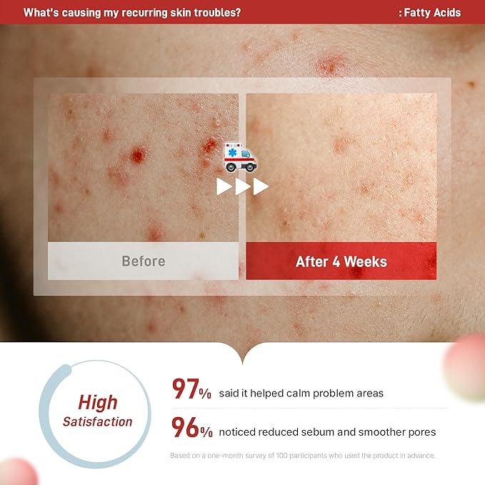 Zeroca 81 Korean Calming Cream for Acne-Prone & Sensitive Skin – Lightweight and gentle daily soothing moisturizer, Controls Sebum, Deeply Hydrates & Smooths Texture (2.02 fl.oz. 60 ml)