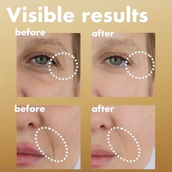 ISOI Intensive Energizing Cream EX, Deep Moisturizing Formula for Skin Elasticity & Firmness, Face & Neck Firming Cream, Korean Skin Care (0.68 fl. oz, 20ml)