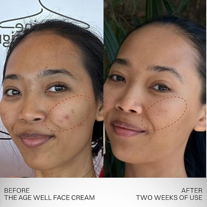 Tano Age Well Face Cream – Retinol Alternative with Banana Sap, Hyaluronic Acid, Vitamin C – Reduces Wrinkles, Firms Skin, Boosts Collagen – Fragrance Free, EU Clean, 1.7oz