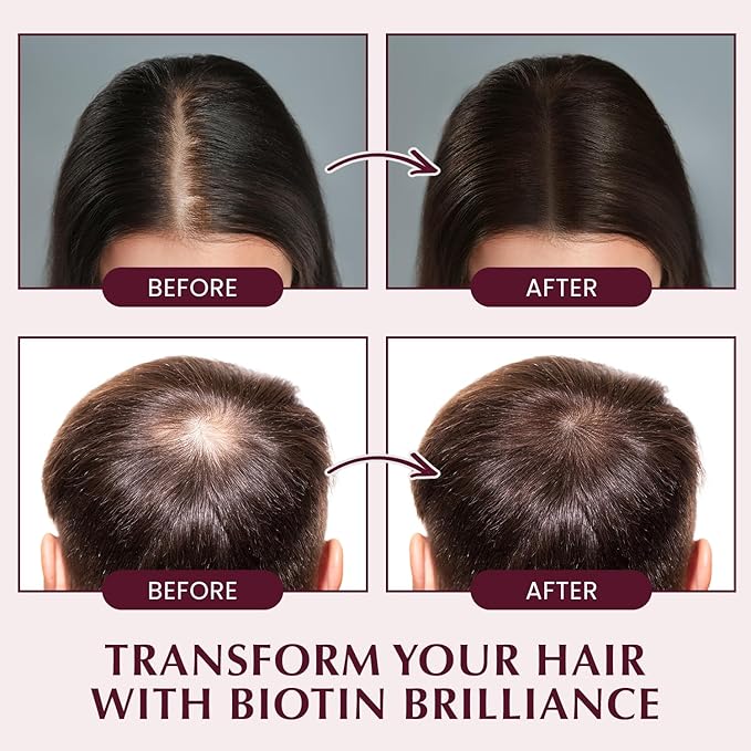 Hair Growth Shampoo for Thinning Hair: Advanced Biotin and Rosemary Shampoo with Rice Water for Women and Men Hair Loss - Herbal Essences Promotes Hair Root Activator, 10.5 Fl Oz
