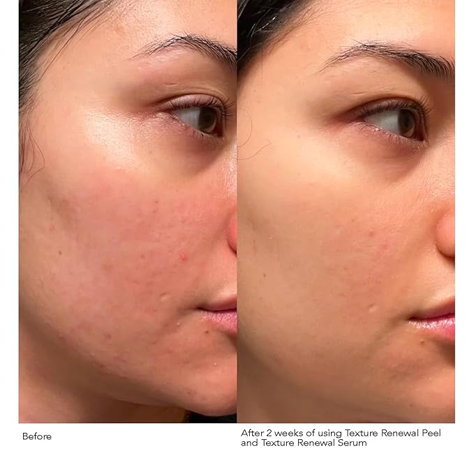 Dr. Dennis Gross Advanced Retinol + Ferulic Texture Renewal Serum – Anti-Aging Formula to Smooth Texture, Boost Radiance, and Minimize Fine Lines & Wrinkles, 1 oz