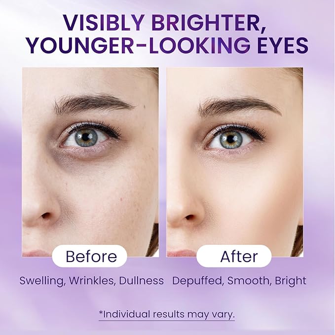 Caffeine & Retinol Under Eye Serum – Dermatologist-Tested, Fast Absorbing, Correction for Puffy Eye Bags Fine Lines Dark Circles Wrinkles While Providing Moisturizing Care