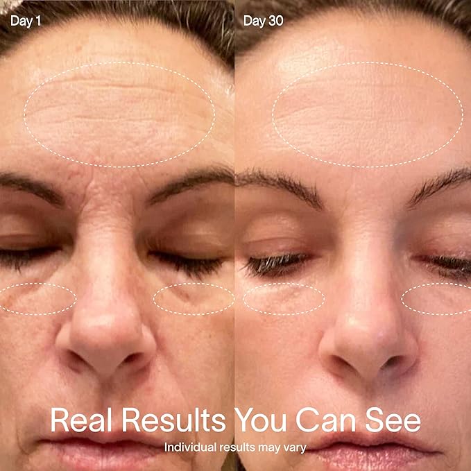 Solawave 4-in-1 Radiant Renewal Red Light Therapy Wand & Renew Complex Activation Serum | Beauty Device for Face & Neck | Serum Boosts Anti-Aging Effects, Reduces Wrinkles, Dark Circles & Puffiness