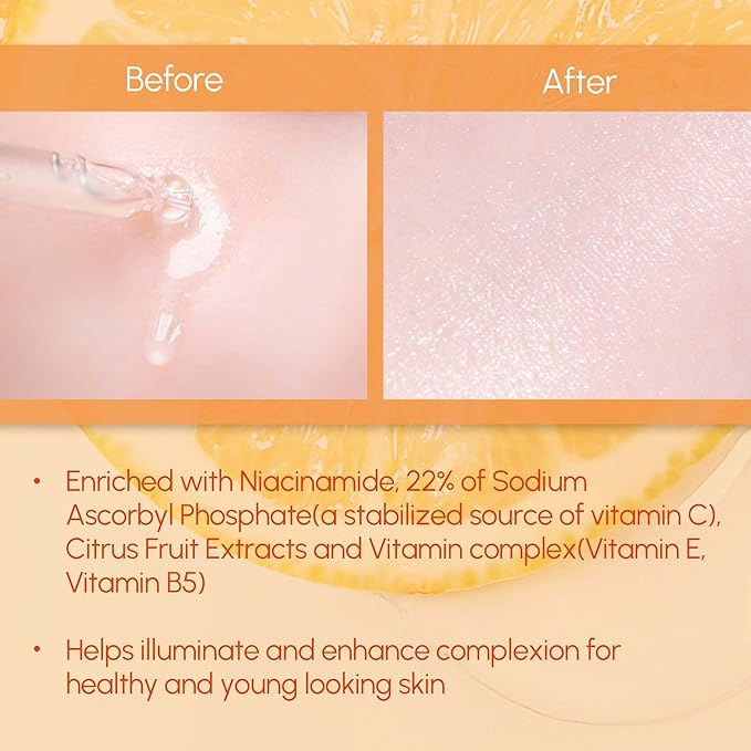 DERMALOGY by NEOGEN Vita C Serum 22% with Pure Ascorbic Acid,vitamin complex (Vitamin E, Vitamin B5) and Niacinamide -1.12 fl oz (Pack of 2)