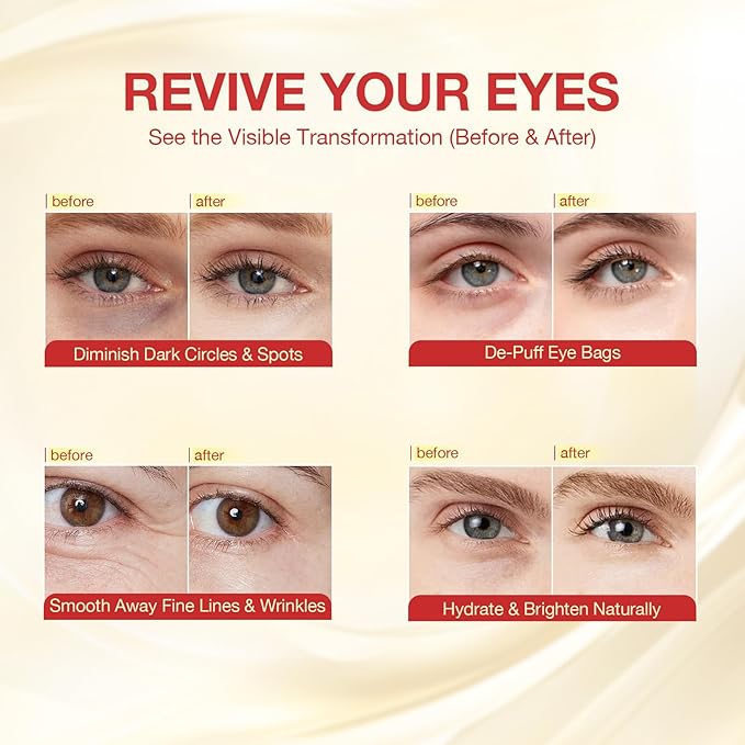 GONIM Under Eye Patches 360° Fit, Eye Mask with Collagen Peptide, Salmon DNA PDRN, Retinol & Niacinamide, Eye Patches for Puffy Eyes and Dark Circles, Travel Essentials 4 pairs