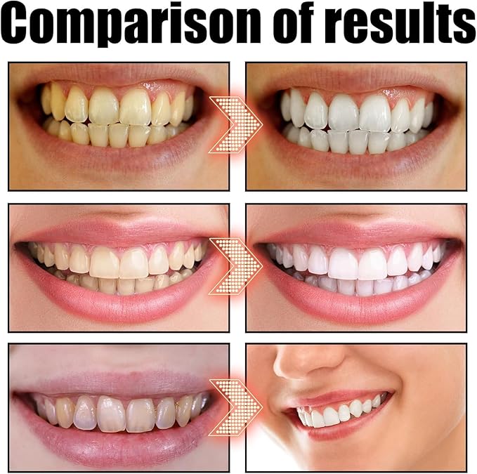 Oil Pulling Rinse - Natural Oral Cleanse & Teeth Whitener, WhiteOil Pulling Rinse, Mouthwash with Organic Cold-Pressed Coconut 𝐎il, Fresh Breath, Say Goodbye to Bad Breath (1)