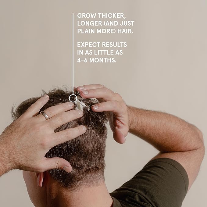 Keeps Extra Strength Minoxidil for Men - 5% Minoxidil Foam Hair Loss & Regrowth Treatment for Thinning & Bald Spots - Clinically Proven Hair Growth Products - Unscented Topical Aerosol Foam