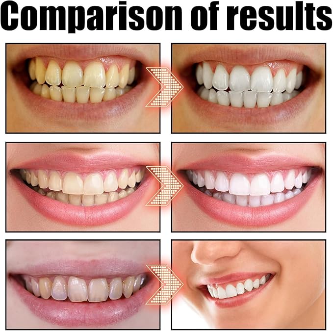 Spearmint Oil Pulling Mouthwash – Cold-Pressed Coconut Oil for Teeth Whitening, Fresh Breath & Oral Detox, 8oz