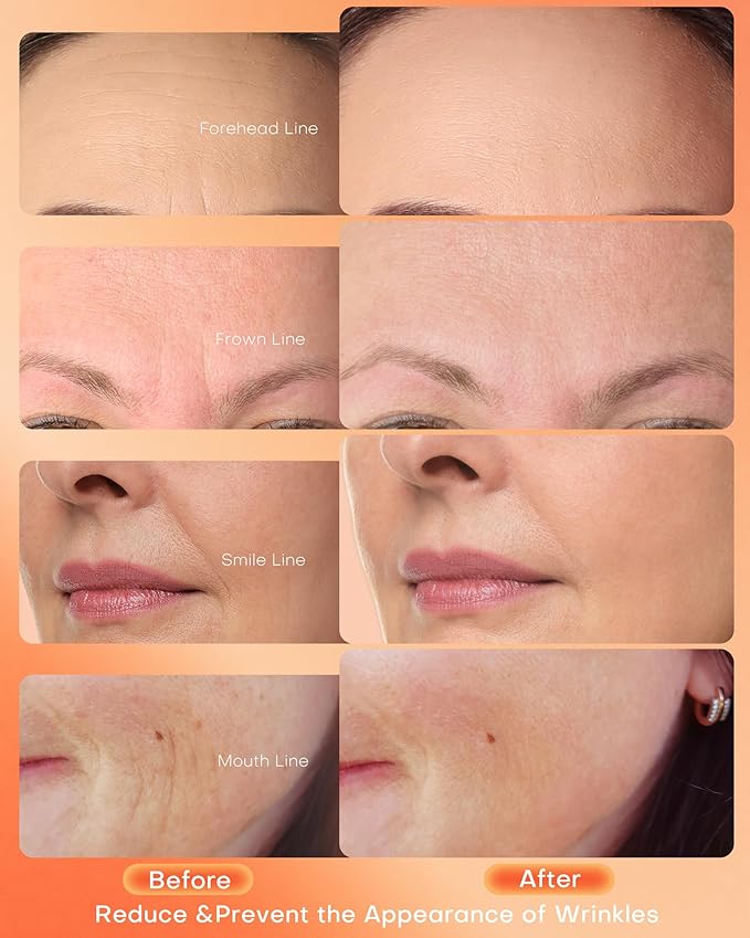 NEWKEY Red Light Therapy Mask for Face,7 Colors LED Face Mask Light Therapy, At-Home Photon Skin Care Beauty Mask for Anti Wrinkles Acne Reduction